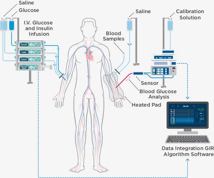 Graphic of ProSciento's Automated Glucose Clamp System